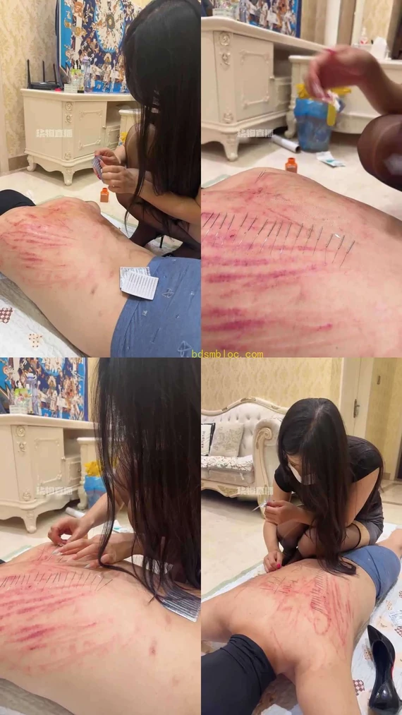 【玉米sss】穿刺花背口水消毒
